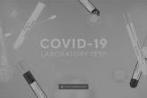 Testcov